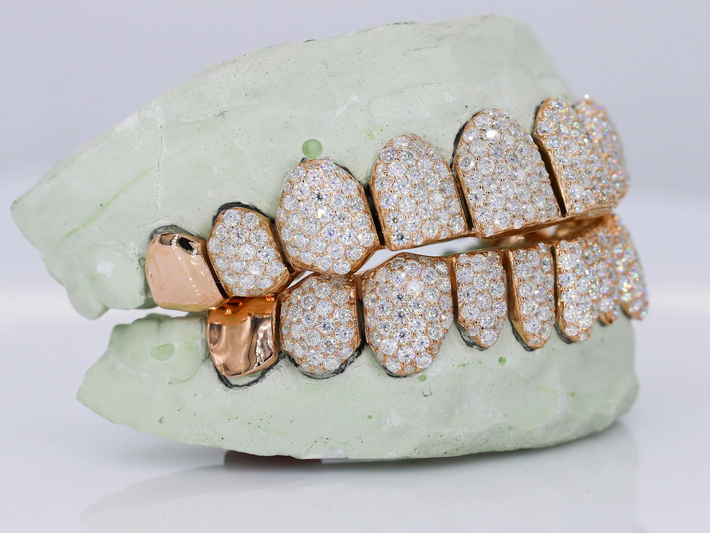 10 on 10 Capped VVS Moisannite Diamond Grillz