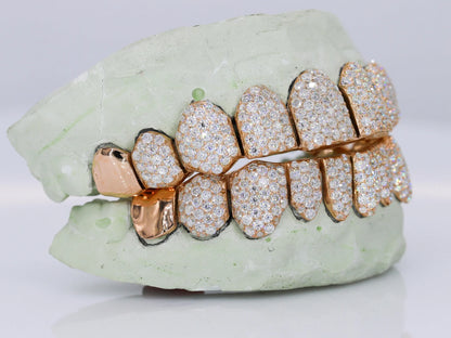 10 on 10 Capped VVS Moisannite Diamond Grillz